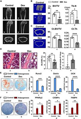 SENP3-Mediated PPARγ2 DeSUMOylation in BM-MSCs Potentiates Glucocorticoid-Induced Osteoporosis by Promoting Adipogenesis and Weakening Osteogenesis